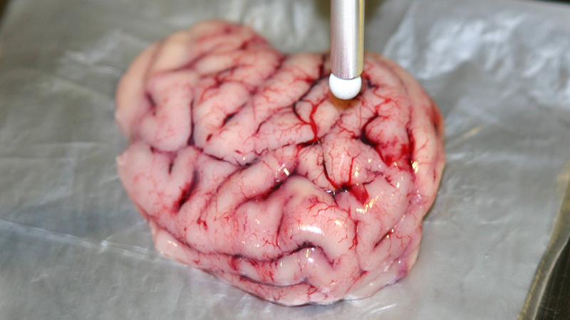 Illustration for article titled Smart Scalpel Can Distinguish Between Healthy and Cancerous Brain Tissue